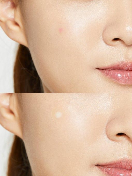 Cosrx Acne Pimple Master Patch - Image 5