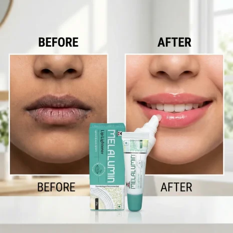 Melalumin Lip Lightener Melalumin Lip Lightener
