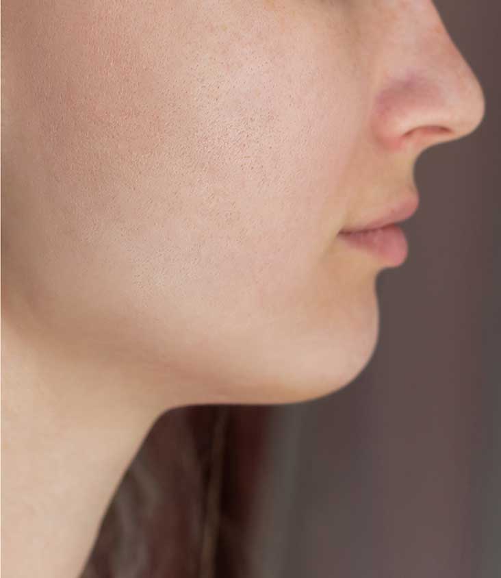Beautybellbd | Best Skin Care Products Price in Bangladesh 14 rash-after