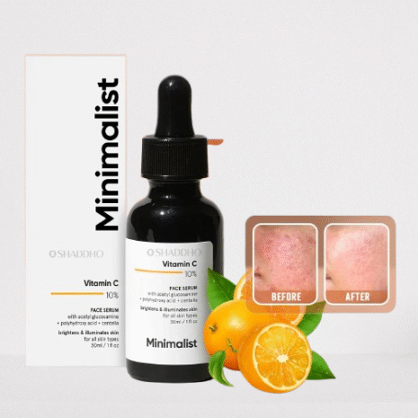 Afe3H01vMZWwo9XyYdQFrIL0031o4TSa2xcD1PVd-removebg-preview Afe3H01vMZWwo9XyYdQFrIL0031o4TSa2xcD1PVd-removebg-preview