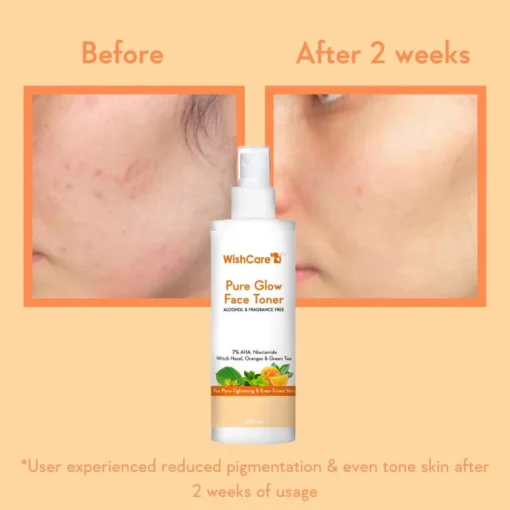 WishCare Pure Glow AHA Face Toner (200ml)  (0 reviews) - Image 5