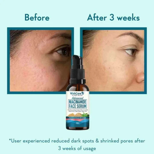 WishCare 12% Niacinamide Serum (30ml) - Image 2