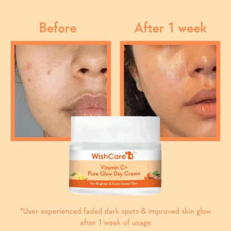 WishCare Vitamin C+ Pure Glow Day Cream WishCare Vitamin C+ Pure Glow Day Cream moisturizer