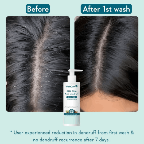 WishCare AHA BHA Anti Dandruff Shampoo WishCare AHA BHA Anti Dandruff Shampoo shampoo