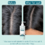 WishCare AHA BHA Anti Dandruff Shampoo shampoo