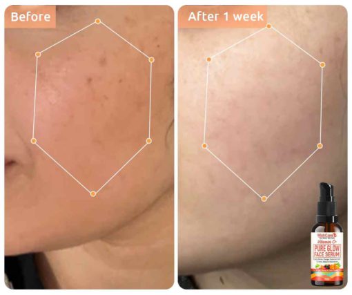 WishCare Vitamin C+ Pure Glow Face Serum (30ml) - Image 2