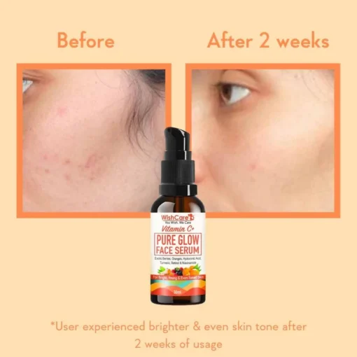 WishCare Vitamin C+ Pure Glow Face Serum (30ml) - Image 5