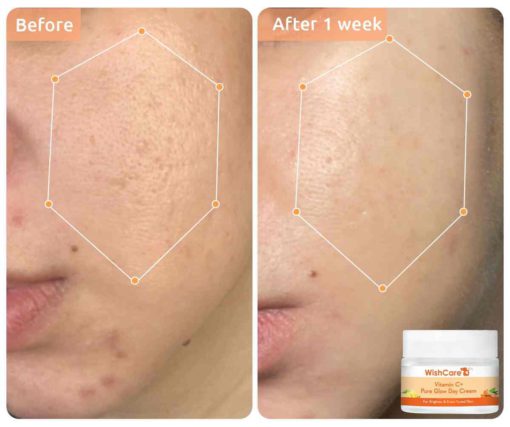 WishCare Vitamin C+ Pure Glow Day Cream (50g) - Image 2