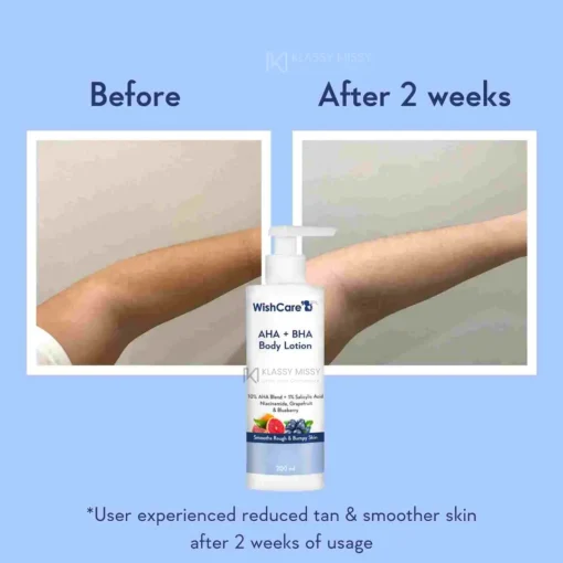 WishCare AHA + BHA Body Lotion Smooths Rough & Bumpy Skin (200ml) - Image 2