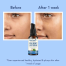 WishCare 2% Salicylic Acid Face Serum serum