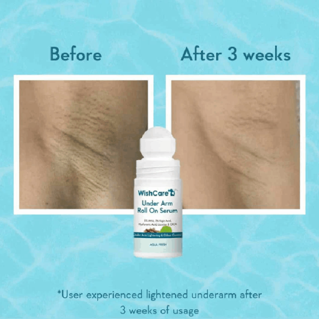 Wishcare Under Arm Roll On Serum Wishcare Under Arm Roll On Serum serum