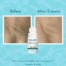 Wishcare Under Arm Roll On Serum serum