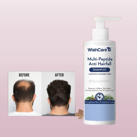 7lzVIcDOZnku7M4JTulvxbODXdsRWuRDy2q1s4nf-removebg-preview 7lzVIcDOZnku7M4JTulvxbODXdsRWuRDy2q1s4nf-removebg-preview