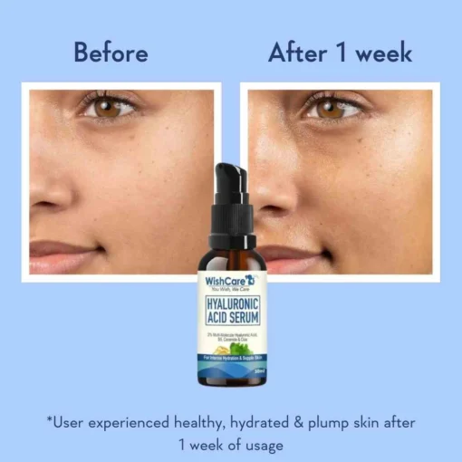 WishCare Hyaluronic Acid Serum (30ml) - Image 5