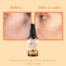 WishCare Vitamin C+ Pure Glow Face Serum serum
