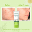 WishCare 2% Salicylic Acid Face Wash cleanser