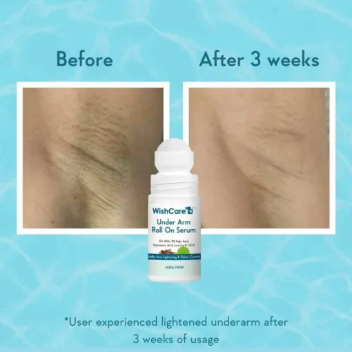 Wishcare Under Arm Roll On Serum (50ml) - Image 3