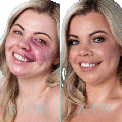 IMG_4843-600x594-removebg-preview IMG_4843-600x594-removebg-preview