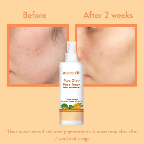 WishCare Pure Glow AHA Face Toner WishCare Pure Glow AHA Face Toner