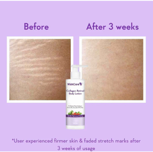 WishCare Collagen 1% Retinol Body Lotion (200ml) - Image 3