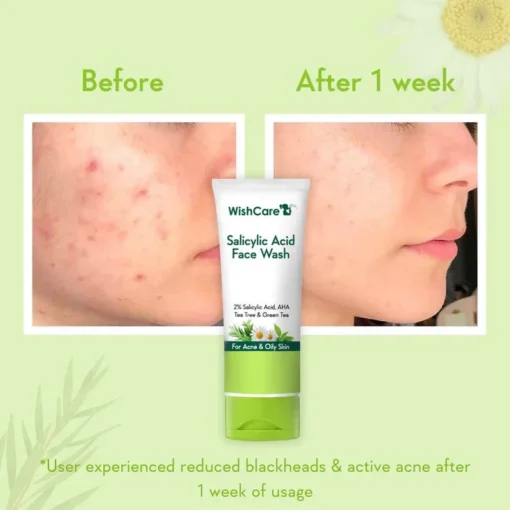 WishCare 2% Salicylic Acid Face Wash (100ml) - Image 3