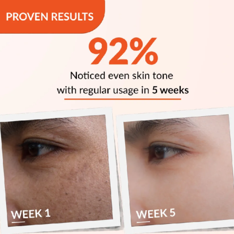 Fixderma Skarfix TX Cream Fixderma Skarfix TX Cream