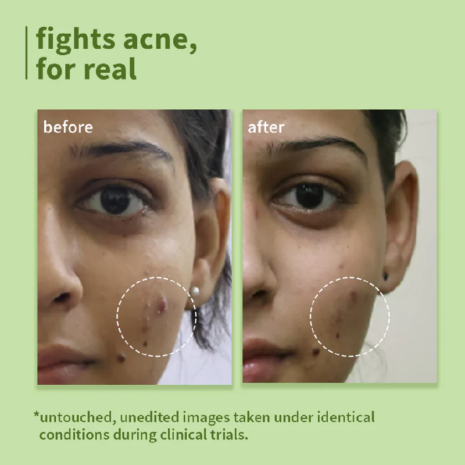 Plum Green Tea Pore Cleansing Face Wash Plum Green Tea Pore Cleansing Face Wash