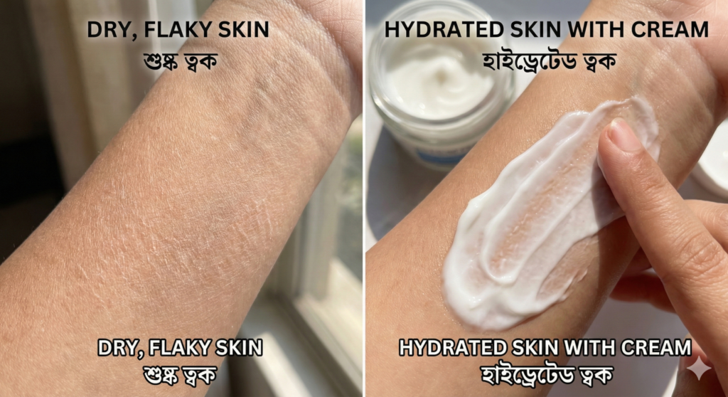 mportance of moisturizer for dry skin in winter