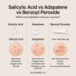 Comparison graphic showing salicylic acid, adapalene and benzoyl peroxide acne treatments with blackheads, clogged pores and inflamed pimples