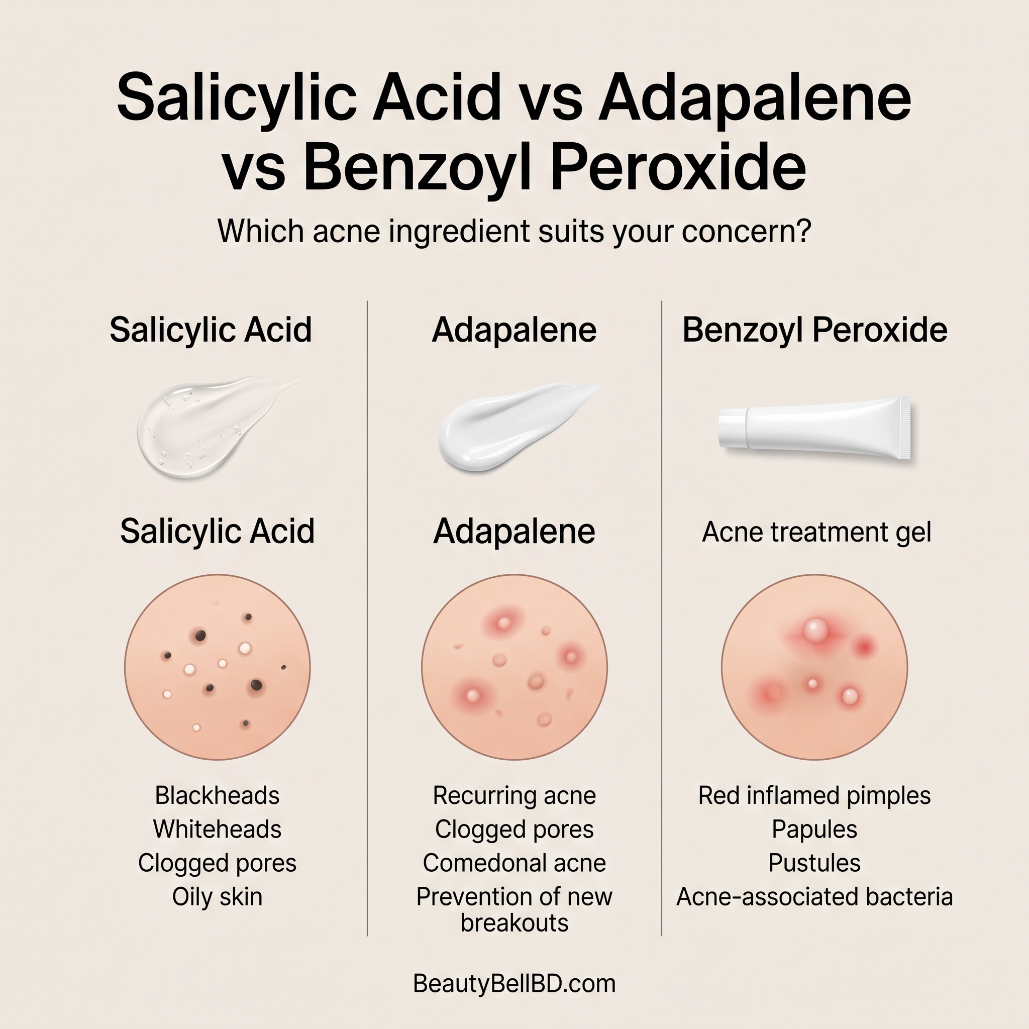 Comparison graphic showing salicylic acid, adapalene and benzoyl peroxide acne treatments with blackheads, clogged pores and inflamed pimples