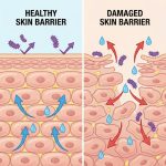 Skin Barrier Damaged কিনা বুঝবেন কীভাবে? লক্ষণ, কারণ ও কী করবেন